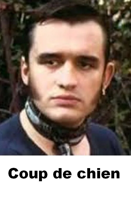 ضربه سگد