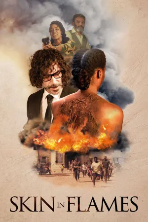 پوست در شعله‌ها