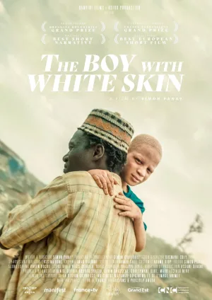 Watch and download The Boy with White Skin online (2024)