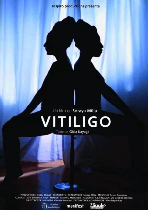 Watch and download Vitiligo online (2019)