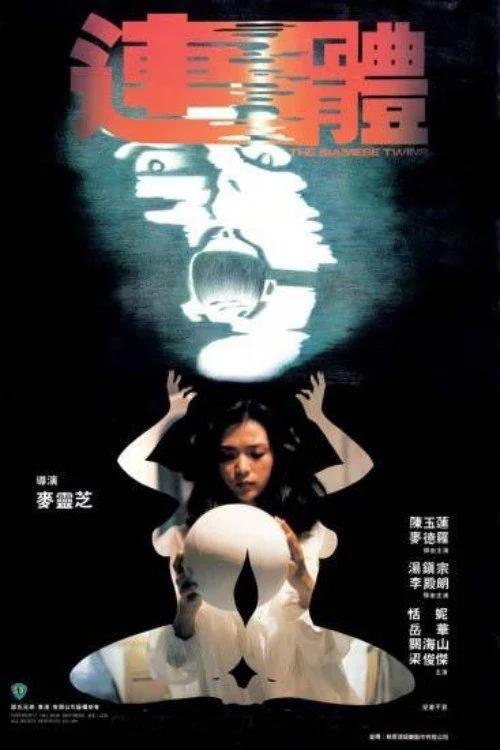 دوقلوهای سیامی