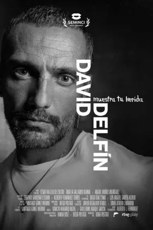 david دل فین، نمایش زخم تو - Poster
